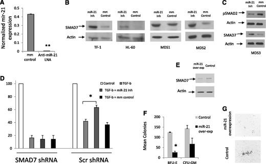 Figure 4. Inhibition of miR-21 can abrogate the effects of TGF-β on hematopoietic cells. miR-21 levels were measured in leukemic K562 cells after 48-hour treatment with LNA inhibitor of miR-21 and compared with mismatched control (mm control). miR-21 transcripts were significantly decreased after LNA treatment (50 mM) as measured by quantitative RT-PCR (mean ± SEM of 2 experiments, Student’s t-test, P < .001). (B) SMAD7 protein expression is increased after miR-21 inhibition (50 mM, 48-hour treatment) in HL-60, TF-1 cell lines and in leukocytes from 2 MDS patients, as shown by immunoblotting. Actin was used as a protein-loading control. (C) miR-21 inhibitor treatment leads to decreased p-SMAD2 in MDS leukocytes when compared with mismatched-control LNAs (50 mM). (D) Primary CD34+ progenitors were nucleofected with GFP coexpressing anti-SMAD7 (or scrambled control) shRNA constructs18 and sorted after 24 hours. GFP-positive cells were grown in methylcellulose in the presence and absence of TGF-β (20 ng/mL) and miR-21 inhibitor (50 mM), and erythroid colonies were counted after 14 days. miR-21 inhibitor treatment abrogates the inhibitory effects of TGF-β on erythroid colonies (mean ± SEM of 2 independent experiments, Student’s t-test, P = .04) in cells that were transfected with scrambled shRNA controls. SMAD7 shRNA–transfected progenitors did not demonstrate any reversal of TGF-β–induced inhibition after miR-21 inhibitor treatment. (E) miR-21 and GFP were co-overexpressed in leukemic K562 cells using the pMIF-cGFP-Zeo vector, leading to decreased levels of SMAD7 as detected by immunoblotting when compared with the GFP-only control. (F) Primary CD34+ progenitors were nucleofected with miR-21and GFP or with the GFP-only control and sorted after 24 hours. GFP-positive cells were grown in methylcellulose in the presence of TGF-β (20 ng/mL) and hematopoietic colonies were counted after 14 days. (G) miR-21 overexpression led to decreased erythroid colony formation (mean ± SEM of 2 independent experiments, Student’s t-test, P = .01) and also led to qualitative reductions in colony sizes.