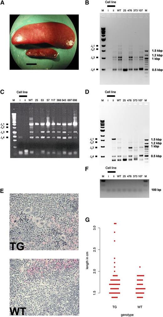 Figure 6. Monoclonal IgH rearrangement in tumors from KSHV latency locus transgenic mice was evaluated using PCR. (A) Splenomegaly found in a KSHV latency locus transgenic mouse with the spleen of a wild-type (WT) mouse. Bar represents 0.5 cm. (B-D) PCR products of splenic genomic DNAs from latency transgenic mice, 2 mouse lymphoma cell lines (i and ii), and 1 C57BL/6 mouse (WT) were resolved on a 1% Tris-acetate-EDTA-agarose gel. The WT lane shows 4 rearrangements of VDJH1, VDJH2, VDJH3, and VDJH4 (B-D) using DH5 (B), Dq52 (C), or VH7183 primers (D). ApoB was amplified to demonstrate an equal amount of genomic DNA was used for PCR (F). Cell lines i and ii mean mouse lymphoma cell lines; K46 and M12. M; 1-kb or 100-bp DNA ladder. Spleen architectures of the same mouse as in Figure 6A (E, TG) and littermate control mouse (E, WT) revealed by hematoxylin and eosin staining. Magnification ×400. (G) Spleen sizes of the KSHV latency transgenic (TG) and littermate control mice (WT) were plotted.