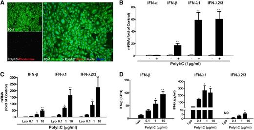 Figure 1. TLR3 activation induced IFN-β and IFN-λ expression. (A) hCMEC/D3 cells were stimulated with 0.1 µg/mL PolyI:C-Rhodamine for 16 hours and cultured for 48 hours poststimulation. Cells were fixed and stained with antibody to ZO-1 tight junction protein (mouse; 1:100; green). After nuclear counterstaining with Hoechst dyes, cells were observed under a fluorescence microscope. White arrows indicate the internalization of PolyI:C (magnification ×100). (B) Effect of PolyI:C on IFN expression of brain ECs. RNA extracted from the cells was subjected to real-time polymerase chain reaction (RT-PCR) for IFNs as indicated. (C,D) Dose-dependent effect of PolyI:C on IFN induction of hCMEC/D3 cells at (C) mRNA and (D) protein levels. Data were the mean ± standard deviation (SD) of 3 independent experiments. Asterisks indicate that the differences between the indicated groups are statistically significant (*P < .05; **P < .01). FITC, fluorescein isothiocyanate; Lyo, LyoVec (transfection reagent).