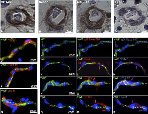 Figure 1. In situ expression of hematopoietic niche markers by human perivascular cells. (A-D) Immunohistochemistry performed on paraffin-embedded sections of 17-week-old human FBM. Pericytes surrounding microvessels express (A) CD146, (B) nestin, (C) CXCL12, and (D) leptin receptor (Lep-R) (original magnification, ×63). (E-S) Immunohistochemistry performed on human adipose tissue cryosections. (E-G) VWF-positive endothelial cells (green) are surrounded by perivascular cells expressing (E) nestin, (F) CXCL12, and (G) Lep-R. (H-S) Triple-staining immunohistochemistry performed on human adipose tissue cryosections shows coexpression of CD146 with (K-M) nestin, (N-P) CXCL12, and (Q-S) LepR. (H-J) Single staining with anti-VWF antibody followed by incubation with conjugated IgG controls revealed the lack of autofluorescence (original magnification, ×40). IgG, immunoglobulin G.