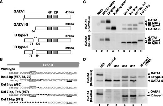 Figure 1. GATA1 mutant proteins with internal deletions. (A) A schema of mutant GATA1 proteins observed in patients with TAM. The amino acid sequence of GATA1-ID proteins was deduced from the sequence of GATA1 cDNA obtained from patients with TAM. Dark boxes indicate N-finger (NF) and C-finger (CF) domains. ID indicates internal deletion. (B) Somatic mutations of the GATA1 gene found in ID type 1 and type 2 patients. Missing, inserted, or substituted nucleotides are highlighted with dark color. A second translation initiation codon located in the third exon is underlined. The AGGT sequence functioning as an alternative splice donor site in mutant GATA1 genes of ID type 1 patients is circled. Note that a mutant GATA1 gene found in TAM patient 71f (ID type 2) lost a splice acceptor site in exon 3 because of the 21-nucleotide deletion. (C) Expression of GATA1 proteins in cells transfected with minigenes using anti-GATA1 antibodies recognizing the C terminus (upper) and residues between the 66th and 78th amino acids (lower) of the GATA1 protein. GATA1-ID proteins are recognized by the antibody against amino acid residues 66-78 of GATA1, whereas GATA1-S is not (lanes 6-9). Cells transfected with mock pcDNA3.1 (lane 1), pcDNA3.1-GATA1 cDNA (lane 2), original minigene (lane 3), and GATA1 minigene harboring a splicing error mutant in the 3′ boundary of intron 113 (lane 4) are used as positive and negative controls for GATA1 and GATA1-S, respectively. (D) GATA1 ID type 1 protein and GATA1-S are detected in the TAM blast cells from patients 80 (lane 4) and 37 (lane 5), whereas only GATA1-S is expressed in the blast cells from patient 86 harboring a conventional type of GATA1 gene mutation in TAM cases (lane 3). Note that relatively abundant GATA1-S is recognized in patient 37 because of the intermixing of genetically distinct clone of cells expressing only GATA1-S (supplemental Table 1). Human erythroleukemia cells (HEL, lane 1) were used as a control for GATA1 and GATA1-S. DS-AMKL cells (CMK11-5, lane 2) and BHK-21 cells transfected with cDNA encoding GATA1 ID type 1 protein (lane 6) were used as controls for GATA1-S and GATA1 ID type 1, respectively.