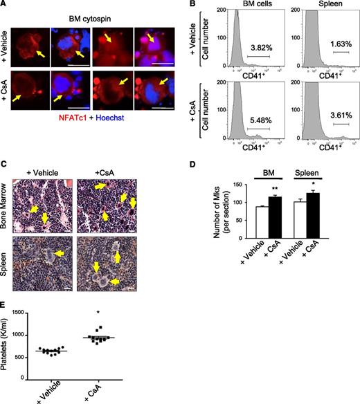 Figure 1. CsA stimulates megakaryopoiesis in vivo. (A) Bone marrow cytospins from wild-type mice treated with the calcineurin inhibitor CsA or vehicle for 6 weeks were immunostained for NFATc1 (red) and Dapi (blue) to examine steady-state NFATc1 subcellular localization. Arrows indicate megakaryocytes. Bar represents 50 μM. (B) Representative histogram of CD41-positive bone marrow and spleen megakaryocytes by flow cytometry from wild-type mice treated for 6 weeks with either vehicle alone or CsA. (C) Hematoxylin and eosin images of bone marrow and spleen sections from CsA-treated mice demonstrate increased numbers of megakaryocytes as compared with vehicle-treated mice as evidenced by hematoxylin and eosin. Arrows denote megakaryocytes. Bar represents 25 μM. (D) Quantification of megakaryocytes in bone marrow (BM) and spleen sections counted in 5 low power fields. Values are mean ± S.D. **P < .03; *P < .05. (E) Circulating platelet counts after vehicle or CsA treatment of wild-type mice for 6 weeks; n = 10; *P < .05.