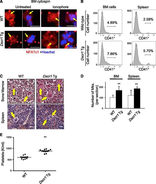 Figure 2. Increased expression of DSCR1 attenuates calcineurin signaling and leads to an increase in megakaryocytes in vivo. (A) Bone marrow (BM) cytospins from wild-type (WT) and Dscr1 Tg mice were treated with and without ionophore and immunostained with anti-NFATc1 (red) and Hoechst (blue). Arrows indicate megakaryocytes. Bar represents 50 μM. (B) Quantification of CD41-positive BM and spleen megakaryocytes either from WT littermate controls or Dscr1 Tg mice by flow cytometry. (C) Hematoxylin and eosin images of BM and spleen sections from Dscr1 Tg mice demonstrate increased numbers of megakaryocytes. Arrows denote megakaryocytes. Bar represents 25 μM. (D) Quantification of megakaryocytes counted in 5 low power fields is shown on the right. Values are mean ± S.D. **P < .03; *P < .05. (E) Circulating platelet counts in Dscr1 Tg mice and WT littermate controls (n = 11).