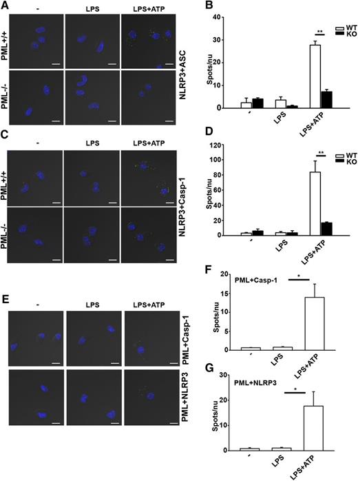 Figure 6. In situ association of NLRP3 and ASC in macrophages is PML-dependent as measured by proximity ligation assay. (A-B) In situ association of NLRP3 and ASC in macrophages activated by LPS and ATP. BMDMs were plated overnight and sequentially stimulated with LPS and ATP as indicated. Macrophages were stained overnight at 4°C with anti-NLRP3 (Cryo-2, mouse MAb) and anti-ASC (AL177, rabbit pAb), followed by oligonucleotide-linked anti-mouse antibodies and anti-rabbit antibodies. After the addition of the template oligonucleotides, the primers in close proximity were allowed to anneal and circularize. The products generated by rolling-circle amplification were detected by hybridization with a Texas red–conjugated probe and were examined under a confocal laser scanning microscope (A). Amplicons were counted in at least 40 cells and divided by the number of cells to obtain spots/ν (nucleus) (B). (C-D) Close proximity between NLRP3 and caspase-1 in activated macrophages. The association of NLRP3 with caspase-1 in macrophages was analyzed (C) and quantitated (D) as in (A) and (B). (E-G) In situ association of PML with NLRP3 or caspase-1 in macrophages activated by LPS and ATP. BMDMs were treated with LPS and ATP, stained with anti-PML (H-238, rabbit pAb) and anti-NLRP3, or with anti-PML and anti-caspase-1, and the association of PML to caspase-1 or NLRP3 was measured (E) and quantified (F-G). The bar represents 10 μm. *P < .05; **P < .01 for paired t-test.