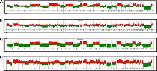 Figure 1. Classification of AA and EA patients by MM subtype using aCGH. Penetrance plots are shown depicting chromosome gains (red) and losses (green) from the analysis of tumor DNA from MM patients. Data were visualized using DNA Analytics software (Agilent). Patients were grouped by race and stratified into the 2 major subtypes, H-MM and NH-MM. Subtype frequencies were compared between the 2 groups: (A) AA H-MM (53%), (B) AA NH-MM (47%), (C) EA H-MM (53%), and (D) EA NH-MM (47%).