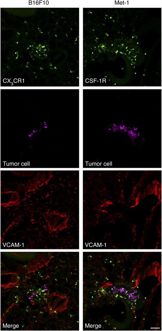 Figure 2. VCAM-1 expression is associated with myeloid cell recruitment. Cx3cr1gfp/+ (left panels; green, myeloid cells) or Csf1r-GFP mice (right panels; green, myeloid cells) were injected intravenously with 5 × 105 CMRA-stained B16F10 or -Met-1 cells, respectively (magenta). Eight hours later, lungs were harvested and assessed by immunohistochemistry for VCAM-1 expression (red, Alexa Fluor 633). Representative images, acquired with a confocal microscope from 3 independent experiments performed, are shown. Scale bars represent 50 µm.