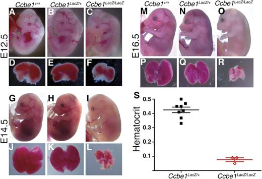 Figure 2. Ccbe1lacZ/lacZ embryos exhibit midgestation anemia associated with reduced fetal liver size. (A-F) E12.5 Ccbe1lacZ/lacZ embryos do not appear paler than littermates and have normal or slightly reduced fetal liver sizes compared with littermate controls. (G-L) E14.5 Ccbe1lacZ/lacZ embryos appear paler than littermates and have markedly smaller fetal livers that are also pale when compared with littermate controls. (M-R) By E16.5, Ccbe1lacZ/lacZ embryos are severely pale and have markedly small and pale fetal livers. (S) Midgestation Ccbe1lacZ/lacZ embryos exhibit severely reduced hematocrits compared with heterozygous littermates on a C57Bl/6 background. Bars indicate mean and standard error of the mean (SEM).