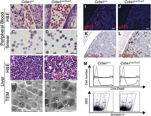 Figure 3. Ccbe1lacZ/lacZ embryos have reduced numbers of anuclear erythrocytes in the peripheral blood and reduced cell proliferation and increased cell death in the fetal liver. (A-D) Peripheral blood in Ccbe1lacZ/lacZ embryos reveals a large fraction of nucleated erythrocytes when examined in H&E-stained sections (A,B) or peripheral blood smears (C,D). (E-H) Ccbe1lacZ/lacZ fetal livers have large numbers of cells with pyknotic nuclei when examined in H&E-stained sections (E,F) and nuclear fragmentation consistent with apoptosis when examined using transmission electron microscopy (G,H). (I,J) Ccbe1lacZ/lacZ fetal livers exhibit reduced cell proliferation as measured by immunostaining for phospho-histone H3. (K,L) Ccbe1lacZ/lacZ fetal livers exhibit increased apoptosis as measured by immunostaining for activated caspase 3. (M) Flow cytometric analysis of Ccbe1lacZ/lacZ fetal livers reveals large numbers of dead (top) and apoptotic (bottom) cells compared with wild-type littermate controls. * indicates fragmented, apoptotic nucleus. Scale bars represent 25 μm. aCasp 3, activated caspase 3; EB, erythroblast; MΦ, macrophage; pH3, phospho-histone H3; TEM, transmission electron microscopy.