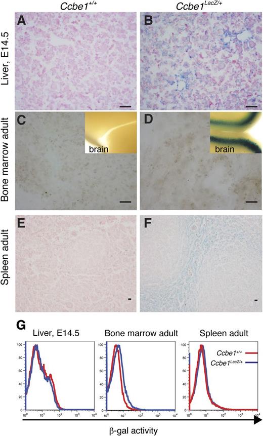 Figure 6. Ccbe1lacZ expression in prenatal and postnatal sites of erythropoiesis. (A,B) X-gal staining of E14.5 Ccbe1lacZ and littermate control fetal liver is shown. (C,D) X-gal staining of bone marrow stroma from Ccbe1lacZ and littermate control animals. Brain tissue from each animal was used as a control for the staining process (insets). (E,F) X-gal staining of Ccbe1lacZ and littermate control spleen. (G) FACS-Gal analysis of hematopoietic cells from the fetal liver, bone marrow, and spleen of Ccbe1lacZ and littermate control animals is shown.