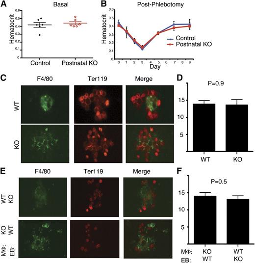Figure 7. CCBE1 is not required for postnatal erythropoiesis or bone marrow EBI formation. (A) Loss of Ccbe1 was induced by tamoxifen administration to Ub-CreERT2; Ccbe1fl/lacZ (postnatal KO) and Ub-CreERT2; Ccbe1fl/+ (control) mice and hematocrits measured 12 weeks later. (B) Ub-CreERT2; Ccbe1fl/lacZ (postnatal KO) and control Ub-CreERT2; Ccbe1fl/+ (control) mice were phlebotomized 12 weeks after tamoxifen-induced deletion of Ccbe1 and hematocrits measured at the indicated time points after phlebotomy. n = 5 in each group. (C,D) Native EBIs isolated from postnatal KO (KO) bone marrow have similar numbers of Ter119+ erythroblasts adherent to F4/80+ macrophages as those from wild-type littermates. (E,F) Reconstituted EBIs reveal normal adhesion of CCBE1-deficient (KO) erythroblasts to wild-type F4/80+ macrophages, and vice versa. n = 12 to 45 islands per group; error bars indicate SEM. EB, erythroblast; MΦ, macrophage; WT, wild-type.