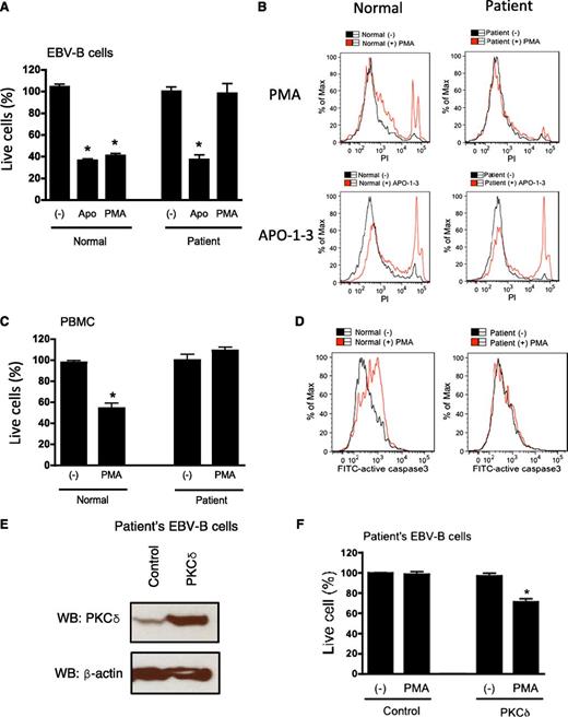 Figure 6. Patients’ B cells were resistant to PMA-induced cell death. (A) and (C) EBV-transformed B cells or PBMCs were cultured with PMA (100 ng/mL) or APO-1-3/protein A (1 μg/mK each). After 24 hours (for EBV B cells) or 48 hours (for PBMCs), cells were stained with DiOC6 (40 nM) for 15 minutes and live cells were counted by flow cytometry by constant time acquisition. (B) EBV-transformed B cells were stimulated with or without PMA or APO-1-3 for 6 hours, stained with propidium iodide (PI; 50 ng/mL) for 15 minutes, and analyzed by flow cytometry. (D) EBV-transformed B cells were stimulated with or without PMA for 3 hours, and cells were stained with FITC-activated caspase-3 (BD Pharmingen) according to the manufacturer’s instructions. (E) and (F) The patient’s EBV-transformed were transduced with pLVX-IRES-ZsGreen control vector or pLVX-IRES-ZsGreen-RRKCD using lentivirus system. Overexpression of PKCδ was analyzed by western blots (WB; E). Cells were stimulated with PMA (100 ng/mL) for 24 hours, live cells were counted by flow cytometry by constant time acquisition (F). Analysis was performed by gating on live ZsGreen expressed cells. Data are represented as means ± SE of 3 separate experiments. *P < .05 by Student t test for comparison with untreated cells.