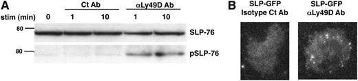 Figure 1. SLP-76 is phosphorylated and recruited to plasma membrane clusters following Ly49D receptor stimulation. (A) Ly49D+ splenic NK cells were enriched and expanded in IL-2 for 6 days. The expanded NK cells were then left unstimulated or stimulated with soluble isotype Ct Ab or anti-Ly49D Ab for 1 or 10 minutes and analyzed for total and phosphorylated SLP-76 by western blot. One representative of 3 independent experiments is shown. (B) Splenic NK cells from GFP-tagged SLP-76–transduced BM chimeric mice were enriched for Ly49D expression, expanded in IL-2 for 6 days, and stimulated on an isotype control Ab or anti-Ly49D Ab-coated surface. Clustering of SLP-76 at the plasma membrane was imaged by TIRF microscopy. Scale bar, 45 μm. One representative of 16 independent experiments is shown.