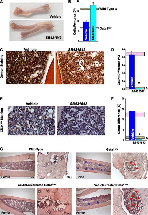 Figure 4. Inhibition of TGF-β1 signaling reduces fibrosis, neo-angiogenesis, and osteogenesis in the BM of Gata1low mice. (A) Morphological appearance of a femur (original magnification ×1.5), (B) BM cellularity, and representative (C-D) reticulinic fiber determinations by Gomori-Silver and (E,F) microvessel density determinations by CD34 staining of femur sections from vehicle- and SB431542-treated Gata1low mice. Original magnification ×20. Quantification with the Methamorph program of the Gomori-Silver and CD34 staining are presented as mean (±SD) of results obtained with 3 mice per experimental point in D and F. Results are compared with those observed in untreated Gata1low and wild-type littermates (pink and gray horizontal bars). Values statistically different (P < .05) between untreated wild-type and Gata1low mice and vehicle- and SB431542-treated Gata1low mice are indicated by & and *, respectively. (G) Hematoxylin-eosin staining of femur/tibias from untreated wild-type and Gata1low mice or from Gata1low mice treated with either SB431542 or vehicle, as indicated. Representative areas of medulla entrapped within the bone are presented at larger magnification on the right. Blue arrowheads indicate bone trabeculae protruding within the medulla. Red arrowheads indicate MKs embedded in areas of medulla surrounded by the bones. Magnification ×4 and ×20, as indicated.