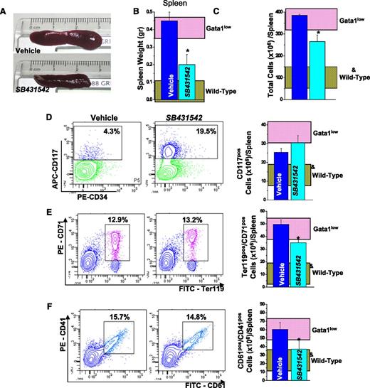 Figure 6. Inhibition of TGF-β1 signaling reduces splenomegaly in Gata1low mice. (A) Morphological appearance (original magnification ×1.5), (B) weight, and (C) total cell number of a representative spleen from vehicle- and SB431542-treated Gata1low mice, as indicated. (D) Frequency by flow cytometry for CD117/CD34 expression and total number of progenitor cells, (E) frequency by flow cytometry for Ter119/CD71 expression and total number of erythroid cells, and (F) frequency by flow cytometry for CD61/CD41 expression and total number of MKs in the spleen from vehicle- and SB431542-treated Gata1low mice are also presented. Results are compared with those observed in untreated Gata1low and wild-type animals (pink and gray horizontal bars). Total numbers of progenitor cells, erythroid cells, and MKs are calculated by multiplying the frequency of the different populations obtained by FACS (Table 6) per the total number of cells in the organs of the animals analyzed in these experiments and are presented as mean (±SD) of 5-6 independent determinations per experimental point. Values statistically different (P < .05) between untreated wild-type and Gata1low mice and vehicle- and SB431542-treated Gata1low mice are indicated by & and *, respectively.
