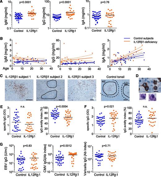 Figure 5. IL-12Rβ1–deficient subjects display low-avidity TT-specific IgG. (A) Serum IgM, IgG, and IgA levels in IL-12Rβ1–deficient subjects (n = 25) and control subjects (n = 38). Student t test. (B) Serum Ig levels at different ages. Each dot represents a sample from an individual subject. Linear regression and 95% confidence interval in each group (control or IL-12Rβ1 deficient) are indicated by solid lines and dotted lines, respectively. (C) CD138 staining of peripheral LN samples from IL-12Rβ1–deficient subjects and tonsil samples from control subjects. T-B cell aggregates in subject 2 are indicated by dotted lines. In control tonsils, secondary follicles are indicated by dotted lines, and the solid lines indicate the border between the mantle zone (MZ) and the GC. Bar equals 100 μm. (D) CD138+ cells with plasma cell morphology. Bar equals 10 μm. (E) TT-specific IgG of serum samples were assessed by enzyme-linked immunosorbent assay. IgG avidity was assessed by the index calculated as a percentage: (OD after urea treatment/OD of the reference well) × 100. (F) Rubella virus–specific IgG levels and their avidities were assessed by enzyme-linked immunosorbent assay. (G) Serum IgG levels against Epstein-Barr virus, cytomegalovirus, and varicella virus in IL-12Rβ1–deficient subjects and control subjects. Student t test.