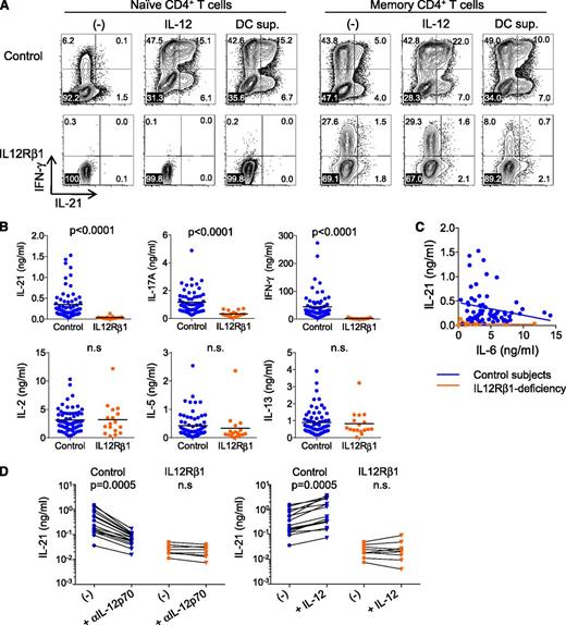 Figure 6. Altered IL-21 secretion by IL-12Rβ1–deficient CD4+ T cells. (A) Intracytoplasmic cytokine expression by naïve and memory CD4+ T cells from an IL-12Rβ1–deficient subject and healthy subjects after 8-day culture with anti-CD3/CD28 and either IL-12 or CD40L-stimulated DC supernatant. (B) Cytokine secretion from PBMCs stimulated for 48 hours with SEB. Mann-Whitney test. Control subjects (blue), n = 65; IL-12Rβ1–deficient subjects (orange), n = 17. (C) Associations between IL-6 concentrations and IL-21 concentrations in culture supernatant of PBMCs stimulated with SEB. (D) Contribution of IL-12 in IL-21 secretion. An (left) IL-12p70 blocking antibody or (right) IL-12 (10 ng/ml) was added to the PBMC cultures with SEB. Paired Student t test. Control subjects (blue), n = 16; IL-12Rβ1–deficient subjects (orange), n = 8.