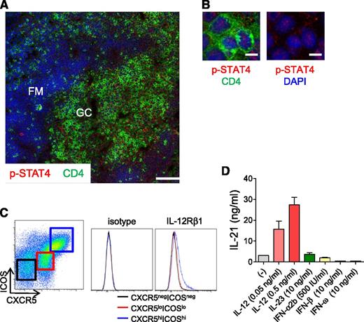 Figure 7. IL-12/STAT4 signaling in human tonsillar GC Tfh cells. (A) p-STAT4 expression by GC Tfh cells. Cells expressing p-STAT4 (red) and CD4 (green) in human tonsil were analyzed by confocal microscopy. Blue indicates DAPI staining. DZ, dark zone; FM, follicular mantle; LZ, light zone. Bar equals 100 μm. (B) Nuclear localization of p-STAT4 in Tfh cells is shown on the right with DAPI staining. Bar equals 10 μm. (C) Expression of IL-12Rβ1 on tonsillar GC Tfh (CXCR5hiICOShiCD4+ T) cells. (Left) Gating strategy for CXCR5−ICOS−, CXCR5loICOSlo, and CXCR5hiICOShi within CD3+CD4+ T cells. Representative results from 3 independent experiments. (D) IL-21 secretion by tonsillar GC Tfh cells in response to IL-12. Tonsillar Tfh cells were stimulated for 3 days with autologous SEB-pulsed B cells in the presence of IL-12, IL-23, or type I IFNs. Representative results from 3 independent experiments.