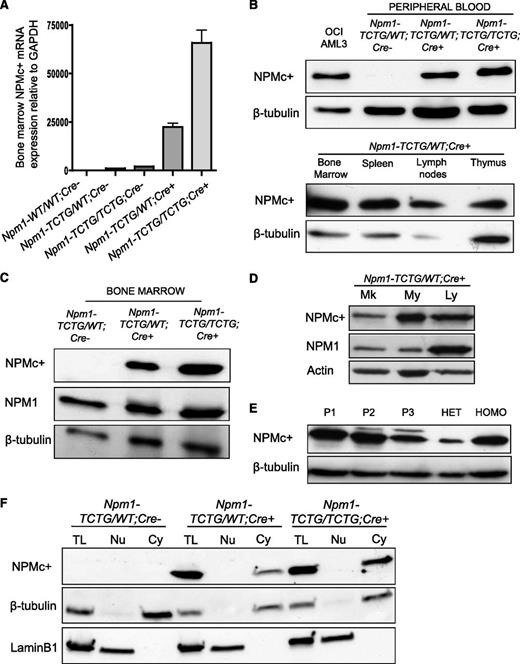 Figure 2. Expression levels of the NPM1 mutation A in mouse hematopoietic tissues. (A) RT-PCR detected transcription of the NPM1 mutant (NPMc+) mRNA in the BM of mutant mice 2 months after pIpC induction of the Cre. (B) Expression of the NPM1 mutant protein in peripheral blood lysates (left) and in hematopoietic tissues (right) using a specific antibody against the mutant. (C) Different expression levels of the NPM1 mutant in BM cells from heterozygous (Npm1-TCTG/WT;Cre+) vs homozygous (Npm1-TCTG/TCTG;Cre+) mice normalized to endogenous Npm1. (D) Western blot of magnetic-activated cell sorting–sorted CD41+ megakaryocytic (Mk), Gr-1+ myeloid (My), and CD3/B220+ T- and B-lymphoid (Ly) cells compared with whole BM of Npm1-TCTG/WT;Cre+ pIpC-induced mice. (E) NPM1 mutant protein expression in 3 different NPM1-mutated AML patients (P1, P2, and P3) compared with heterozygous (HET) and homozygous (HOMO) mutant mice BM. (F) Western blot analysis of NPMc+ expression on nuclear and cytoplasmic fractions of BM cells from heterozygous and homozygous mutant mice. C, cytoplasmic fraction; N, nuclear fraction; TL, total lysate.