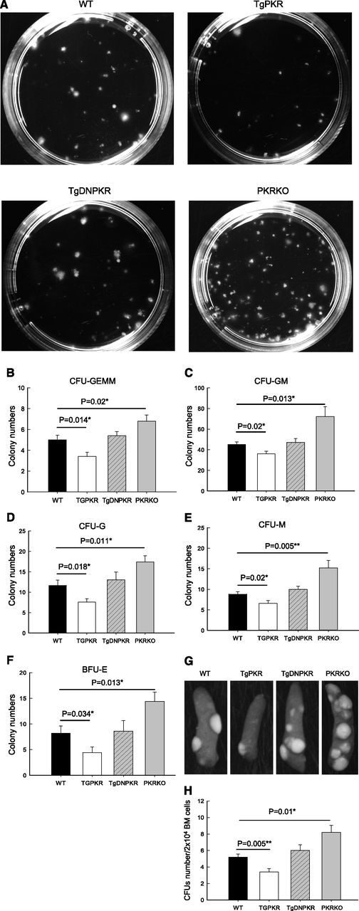 Figure 3. PKR regulates clonogenic potential of BM progenitors both in vitro and in vivo. (A) Representative colonies after culture of WT, TgPKR, TgDNPKR, or PKRKO BM cells from 3- to 5-month-old mice in methylcellulose for 7 days. (B-F) Unfractionated BM cells (2 × 104 for B, C, D, and E, 105 for F) from WT, TgPKR, TgDNPKR, or PKRKO mice were plated and resulting CFU-GEMM (B), CFU-GM (C), CFU-G (D), CFU-M (E), and BFU-E (F) counted. BM from 5 mice of each genotype was assayed and mean ± SEM graphed. (G) Representative examples of macroscopic spleen colonies (CFU-S) from WT irradiated recipients injected with 2 × 104 unfractionated BM cells either from WT, TgPKR, TgDNPKR, or PKRKO mice as indicated. (H) Colonies were counted 10 days after transplantation. Graphs represent mean ± SEM (n = 4 donor mice of each genotype).