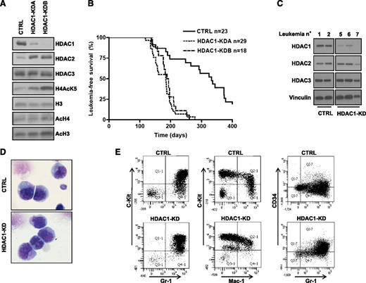 Figure 1. Hdac1 knock-down accelerates APL development. (A) Immunoblot analysis of Hdac1, 2, and 3 expression, and histone 3H/H4 acetylation in GFP+ lin− cells derived from mCGPR/PR mice and transduced with the indicated retroviral vectors. Total histone 3H served as a loading control. (B) Leukemia-free survival curves of mice transplanted with the indicated GFP+ lin− cells. HDAC1-KDA and HDAC1-KDB indicate 2 different shRNA against Hdac1 (supplemental Table 4). CTRL vs Hdac1: P < .0001. (C) Hdac1, Hdac2, and Hdac3 expression in bone marrows of leukemic mice. Vinculin was used as a loading control. (D) Cytologic analysis of APL blasts from the spleens of moribund animals. Original magnification ×1000, May Grünwald-Giemsa staining, Olympus BX51. (E) Representative immunophenotype of leukemic cells derived from the spleens of moribund animals.