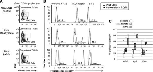 Figure 1. Phospho-NF-κB p65, A2AR, and IFN-γ expression in iNKT cells of controls and patients in steady state and pVOC (stages 2 and 3, respectively) at time 0 (preinfusion). (A) Flow cytometry plot of iNKT cells from controls and patients in steady state and pVOC at time 0. (B) Phospho-NF-κB p65, A2AR, and IFN-γ expression in iNKT cells compared with CD3+ non-iNKT cells at time 0. Solid peaks represent expression in iNKT cells and dashed peaks represent expression in CD3+ non-iNKT cells. Activation gate is defined as increased expression relative to CD3+ non-iNKT cells. Percent of iNKT cells in the activation gate is reported. (C) iNKT cell inflammatory marker data at time 0 for controls (white boxes), patients in steady state (stage 2, hatched boxes), and pVOC (stage 3, dark gray boxes). Lower end of box denotes 25% of data, upper end of box denotes 75% of data, and median is the line within the box. Error bars are the lowest and highest data points within 1.5 times the interquartile range, and circles represent outliers.