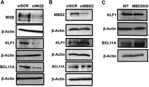 Figure 4. Mi2β positively regulates the expression of KLF1 and BCL11A in CID cells. (A) Western blot showing a decrease in murine KLF1 and murine BCL11A protein levels after Mi2β knockdown in CID cells. (B) Western blot showing no change in murine KLF1 and murine BCL11A protein levels after MBD2 knockdown in CID cells. (C) Western blot showing no change in murine KLF1 or murine BCL11A in primary adult mouse erythroblasts from MBD2 knockout mice.