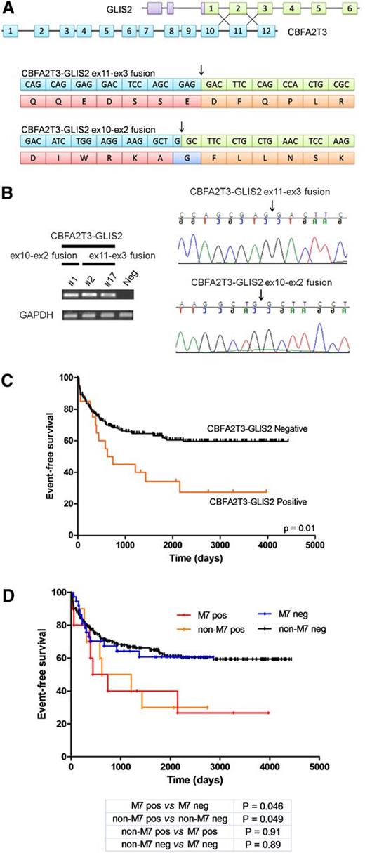 Figure 1. CBFA2T3-GLIS2 fusion transcript is a novel common feature of pediatric CN-AML, predicting poorer outcome. (A) Schematic representation of the fusion between CBFA2T3 and GLIS2 and predicted sequence of the fusion proteins found in CN-AML. The exon-intron gene structures are indicated. The purple blocks represent untranslated exons. Black arrows indicate the fusion breakpoint. (B) RT-PCR analysis and Sanger sequencing performed in order to validate the detection of the CBFA2T3-GLIS2 fusion. Detection of the GAPDH transcript was used as an RNA quality control. A library negative for the CBFA2T3-GLIS2 fusion transcript was used as negative control (Neg). Black arrows indicate the fusion breakpoint. (C) Probability of 5-year EFS in children with CBFA2T3-GLIS2 fusion transcript in CN-AML. EFS of CBFA2T3-GLIS2–positive patients (27.4%, SE 10.5) vs CBFA2T3-GLIS2–negative patients (59.6%, SE 3.6; P = .01). (D) Probability of 5-year EFS in pediatric CN-AML with or without CBFA2T3-GLIS2 fusion transcript stratified according to FAB subgroups (M7 vs non-M7): EFS of non-M7 CN-AML without CBFA2T3-GLIS2 = 59.4%, SE 3.5 vs EFS of non-M7 CN-AML with CBFA2T3-GLIS2 = 30.0%, SE 14.4 (P = .04). EFS of FAB-M7 CN-AML without CBFA2T3-GLIS2 = 60.7%, SE 8.3 vs EFS of FAB-M7 CN-AML with CBFA2T3-GLIS2 = 26.6%, SE 15.0 (P = .04).
