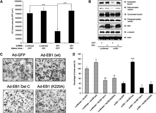Figure 3. Reexpression of wild-type EB1 restores vascular tube formation in EB1 siRNA–treated ECs, but a C-terminal mutant of EB1 without affinity for p150Glued or Clasp1 fails to rescue this phenotype. (A) EB1 siRNA–treated cells were infected with adenoviral vectors carrying GFP or EB1 and allowed to undergo EC tube morphogenesis for 24 hours. Reexpression of EB1 (but not control GFP expression) successfully restores vascular tube formation in these siRNA-treated ECs. Data are presented as lumen area ± standard deviation (SD; n = 6), which was measured by Metamorph software. Statistical significance ***P < .0005. (B) Cell lysates were prepared from the samples in (A) and immunoblots were performed with the indicated antibodies. siRNA suppression of EB1 decreased both acetylated and detyrosinated tubulin, whereas reexpression of EB1 in these cells fully rescued the expression of acetylated and detyrosinated tubulins, which accompanied the restoration of vascular lumen formation. (C) Endothelial cells were induced to express GFP, EB1 (wt), EB1 (K220A), or EB1 δ C using recombinant adenoviral vectors and suspended within collagen matrices for 24 hours in 3D collagen matrices. Cultures were fixed with glutaraldehyde, stained with toluidine blue, and photographed. Scale bar is 100 μm. (D) EB1 or control siRNA-treated cells were induced to express control GFP, EB1 (wt), EB1 (K220A), or EB1 δ C, suspended within collagen matrices and allowed to undergo EC tube morphogenesis for 24 hours. Fixed and stained cultures were quantitated for lumen formation. Data are presented as lumen area ± SD (n = 3). Statistical significance *P < .05, **P < .005, ***P < .0005.