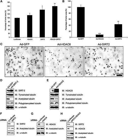 Figure 5. The tubulin deacetylases, HDAC6 and SIRT2, negatively regulate EC lumen and tube formation in 3D matrices. (A) ECs were treated with siRNAs directed to HDAC6 and SIRT2 and their combination, which leads to increased EC lumen formation and increased tubulin. Data are shown as mean EC lumenal area ± standard deviation (SD; n = 6). Statistical significance *P < .05, **P < .005. (B,C) ECs were induced to express HDAC6 vs SIRT2 (vs control GFP) using recombinant adenoviruses, leading to markedly reduced lumen formation after 24 hours of culture. This was assessed by photography (C) and marked loss of acetylated tubulin (D-E) in culture lysates, which correlates with a lack of lumen formation (B-C). Western blots were performed to assess protein knockdown and the levels of acetylated tubulin in the indicated siRNA-treated EC cultures undergoing lumen formation (F-H). Lysates were made after 24 hours of culture. Data are shown as mean EC lumenal area ± SD (n = 6). Statistical significance *P < .05, **P < .005.