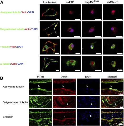 Figure 6. EB1, p150Glued, and Clasp1 control accumulation of acetylated and detyrosinated tubulins in a subapical distribution during EC tubulogenesis in 3D collagen matrices. (A) ECs were treated with control (luciferase), p150Glued, Clasp1, or EB1 siRNAs and suspended within 3D collagen matrices for 24 hours. After fixation, cultures were immunostained with antibodies to the indicated tubulins and modified tubulins. Cultures were costained with AlexaFluorX-conjugated phalloidin to label F-actin and Dapi to label nuclei. Bar equals 20 μm. (B) Day 5 embryonic quail chorioallantoic membranes were stained with the indicated antibodies to label tubulins, with phalloidin to label F-actin, and Dapi to label nuclei within endothelial cells. A subapical distribution of modified tubulins is noted in the developing embryonic quail vasculature along with a basal distribution for F-actin; this recapitulates what we observe using our in vitro EC tubulogenesis model (A). L indicates lumen space. Bar equals 20 μm.