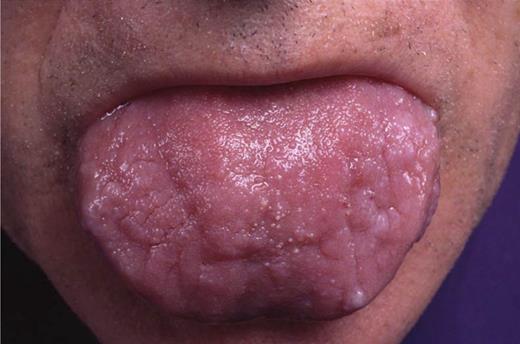 This is not Mick Jagger.