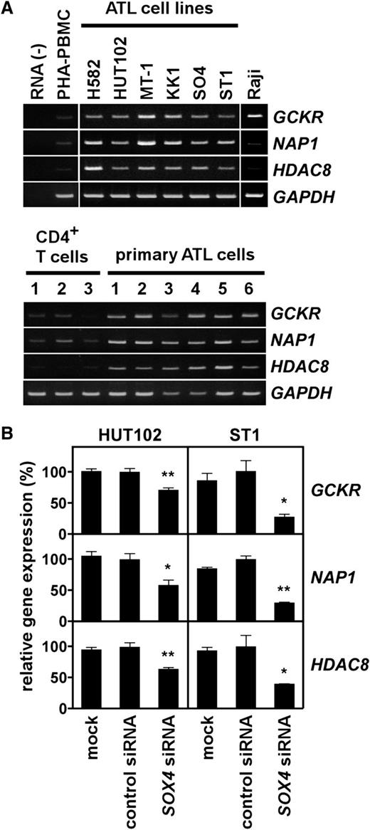 Figure 4. Expression of SOX4 target genes in ATL. (A) Gene expression analysis. Semiquantitative RT-PCR was performed to analyze expression of GCKR, NAP1, and HDAC8 in ATL cell lines and Raji (top panel), and in normal CD4+ T cells and PBMCs from ATL patients (>90% leukemia cells) (bottom panel). PHA-PBMC, normal PBMCs treated with PHA for 3 days. GAPDH was used as a loading control. The representative results from 3 separate experiments are shown. (B) Effect of SOX4 siRNA on target gene expression. Two ATL cell lines (HUT102 and ST1) were transfected with control siRNA or SOX4 siRNA. After 48 hours, total RNA samples were prepared. Quantitative real-time PCR was performed for GCKR, NAP1, HDAC8, and GAPDH. The expression levels were normalized by GAPDH. Data are shown as mean ± SEM of 3 separate experiments. *P < .05; **P < .01.