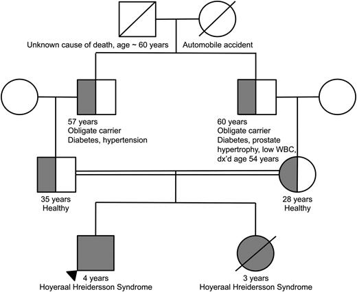Figure 3. Family pedigree demonstrating consanguinity between the proband’s parents. The homozygous proband and deceased sibling are indicated by the completely filled circle/square. The heterozygous parents as well as obligate heterozygous grandfathers are indicated by the half-filled circles/ half-filled squares.