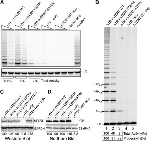 Figure 4. Telomerase activity analyses of TERT p.K570N and p.T567M mutants. (A) Telomerase TRAP assay of TERT mutants. Two concentrations of lysate (3 ng and 0.6 ng of protein) are analyzed in a 2-step TRAP reaction. Control reactions with CHAPS lysis buffer in place of lysate (buffer only) and a telomerase positive cell lysate (positive) are included. (B) Telomerase direct assay of TERT p.K570N and p.T567M mutant telomerase reconstituted in vivo. Cell lysates (1.5 μg of protein) of 293FT cells transfected with TERC and TERT-WT (lane 1), T567M (lane 2), or K570N (lane 3) are analyzed by direct primer extension assays. Transfections of TERC (lane 4) or TERT-WT (lane 5) alone are included as controls. A 32P end-labeled 18-mer oligonucleotide is included as the loading control (L.C.). (C) Western blot of ectopic TERT expression. The glyceraldehyde-3-phosphate dehydrogenase protein is used as the internal control. (D) Northern blot analysis of ectopic TERC expression. The endogenous 5S rRNA is probed to ensure equal loadings.