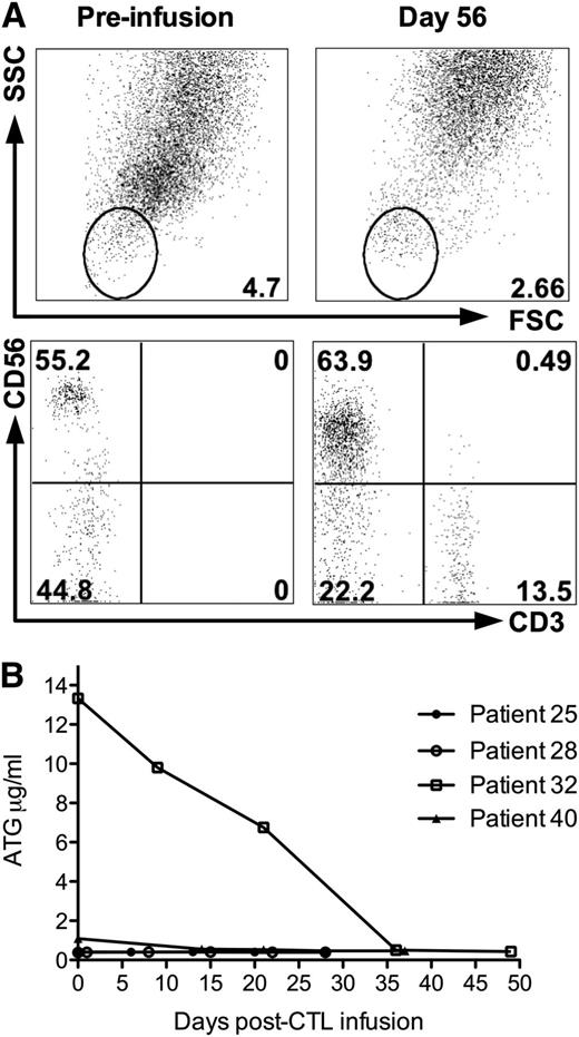 Figure 4. Correlative studies of peripheral blood immunophenotype and ATG levels in patient 32; this patient died of CMV pneumonitis post-CTL infusion. (A) Peripheral blood immunophenotype of lysed whole blood of patient 32 pre-CTL infusion (day 31 posttransplant) and day 56 postinfusion (day 87 posttransplant). (B) Plasma ATG levels in 4 patients who received CTL infusions following conditioning containing ATG. Patient 32 () developed CMV pneumonitis and died 88 days posttransplant (57 days post-CTL infusion). Total doses of ATG administered were: patient 25, 30 mg/kg; patient 28, 15 mg/kg; patient 32, 30 mg/kg; and patient 40, 20 mg/kg.