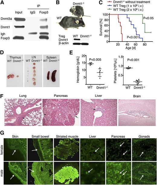 Figure 1. Foxp3cre/Dnmt1−/− mice developed lethal autoimmunity by 3 to 4 weeks of age. (A) In WT Tregs, immunoprecipitation of Foxp3 led to co-precipitation of Dnmt1 and Dnmt3a (immunoglobulin-heavy chain, Igh, is also detected). (B) Male mice with Dnmt1−/− Tregs became sick and runted, whereas WT littermate or female mice developed normally; (inset) representative Western blot showing the absence of Dnmt1 in the Tregs of targeted mice (developed by mating floxed Dnmt1 and Foxp3-Cre mice). (C) Kaplan-Meier survival plots showing death by 3 to 4 weeks of age of all mice with Dnmt1−/− Tregs, whereas their adoptive transfer with WT Tregs at 2 to 4 days of life rescued mice in a dose-dependent manner; data are from 3 to 8 mice per group. (D) Dnmt1−/− mice had small thymii but enlarged lymph nodes and spleens. (E) Dnmt1−/− mice developed anemia and thrombocytopenia; data are from 5 mice per group. (F) Histologic examination mononuclear cell infiltrates of multiple organs, including extensive bronchovascular bundles of the lung, periductular areas of the pancreas, periportal areas of the liver, and submeningeal areas of the brain. (G) Sera of male Dnmt1−/− mice contained autoantibodies directed against stratified squamous keratinizing epithelium in the skin (ear section, 1/40 to 1/80 titer), smooth muscle (eg, small bowel, titers of 1/40 to 1/80), striated muscle (titers of 1/320 to 1/640), nuclei of all tissues (nucleolar pattern, titers of 1/80 to 1/160, eg, in liver and pancreas in males vs unaffected nuclei in females), and antisperm antibodies (titers of 1/20 to 1/40 titers against mature sperm cells located in the central part of seminiferous tubules; arrows point to the tails of spermatozoa); sera from Dnmt1−/− females (upper row) had no autoantibodies and were indistinguishable from the sera of healthy C57BL/6 mice (n = 3/group).