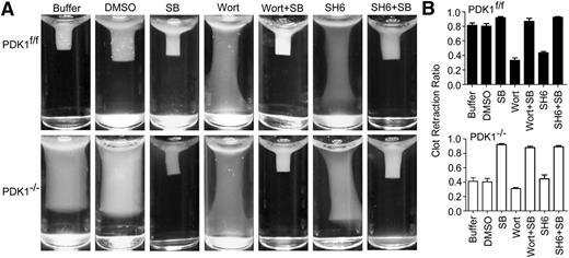 Figure 5. PDK1 regulates clot retraction. (A) Clot retraction of PRP containing PDK1f/f and PDK1−/− platelets in the presence of dimethylsulfoxide, 10 μM SB, 100 nM Wort, 1 μM SH6, or 10 μM SB combined with 100 nM Wort or 1 μM SH6. (B) Two-dimensional retraction of clots was measured using National Institutes of Health Image J software, and the data were expressed as retraction ratios (mean ± standard error of the mean from 3 separate experiments). Statistical significance was calculated using an independent sample Student t test.