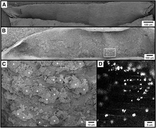 Figure 1. Visualization of the carotid artery endothelial surface by SEM. (A) The image shows a longitudinal section from an untreated mouse, approximately 1.5 mm long. (B-C) The images are of the carotid artery 1 minute following FeCl3 application, visualized by SEM. Thrombotic material can be observed covering much of the endothelial surface. Higher magnification of the area from (B, box) is shown in (C). (D) The fluorescent intravital microscopy image shows FeCl3-induced thrombosis in the mouse carotid artery. Platelets were observed to bind in clusters rather than discretely. The time frame is approximately 30 seconds following the application FeCl3. *, platelet clusters (not all are marked).