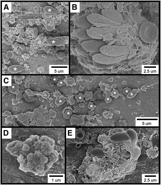 Figure 2. SEM visualization of thrombotic material in the mouse carotid artery induced by FeCl3 application. The figure shows (A) elongated RBCs (asterisks); (B) an RBC cluster; (C) spherical structures (asterisks; not all are labeled); (D) a spherical structure covered with smaller, rough-appearing bodies; and (E) complexes composed of rough and amorphous-appearing material. The time course was 1 minute after FeCl3 application for all samples.