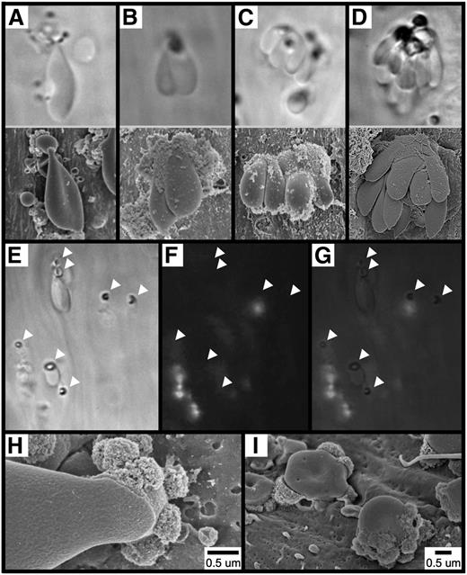 Figure 3. Adhesion of RBCs to the endothelial surface following FeCl3 application. The images in (A-D, upper panels) show the mesenteric venule with visualization by brightfield intravital microscopy (original magnification ×100). The time course was between 1 and 5 minutes after FeCl3 application. The images in (A-D, lower panels), show the carotid artery with visualization by SEM. The time course was 1 minute for (A-C) and 90 seconds for (D) after FeCl3 application. Note that for intravital microscopy, the angle of observation is from “below,” looking up the “underside” of the structures, while the angle of observation for SEM is from “above,” looking down at the “top” of the structures. The images in (E-I) show that the adhesion of RBCs to the endothelial surface is not mediated by platelets or leukocytes. Brightfield (E), fluorescent (F), and merged (G) intravital microscopy imaging was performed on FeCl3-induced RBC adhesion in murine mesenteric venules (rhodamine 6G injected). Arrowheads indicate the locations of firm adhesion points. The time course is approximately 3 minutes following FeCl3 application. (H-I) SEM imaging shows an elongated RBC (H) and RBC fragments (I) directly adherent to the carotid endothelial surface 1 minute following FeCl3 application.