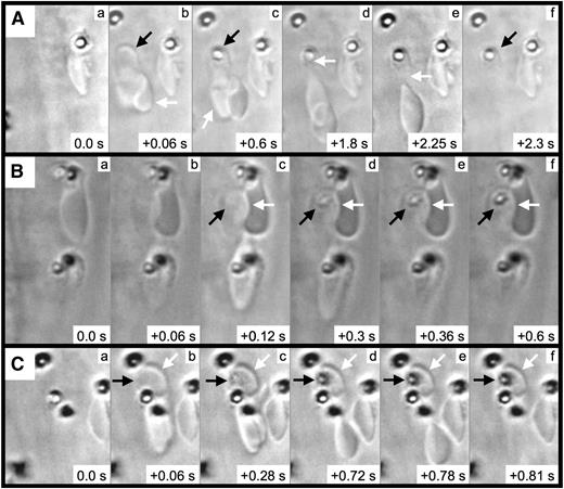 Figure 4. RBC fragment formation in mesenteric venules visualized by brightfield intravital microscopy. Elapsed times from the initial frames (panels a) are as indicated (seconds). For the example shown in (A), 2 RBCs (Ab, arrows) become associated with the endothelial surface; a firm adhesion point becomes visible within 1 of the RBCs (Ac, black arrow), with this RBC becoming elongated in the direction of flow (Ac, white arrow); the elongated RBC appears to be anchored to the firm adhesion point (Ad, white arrow); the elongated RBC breaks free from the firm adhesion point (Ae, white arrow); and the RBC fragment is left associated with the endothelial surface (Af, black arrow). (B-C) The black arrows indicate the firm adhesion point, and the white arrows indicate the adherent RBC fragment.