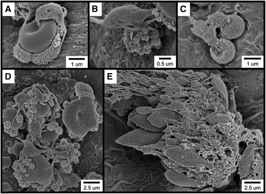 Figure 5. Following FeCl3 application, platelets bind to RBC-derived structures rather than to the intact endothelial surface. (A-E) SEM visualization shows platelets binding to RBC-derived structures. The time course was 1 minute following FeCl3 application for all samples.