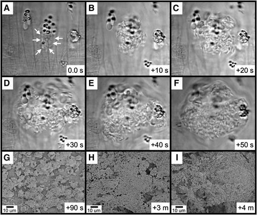 Figure 6. Rapid platelet aggregation on RBC-derived material visualized by brightfield intravital microscopy and SEM. (A-F) The elapsed time from the initial frame (A) is as indicated (seconds). (A) Platelets were observed binding to a group of RBC fragments (arrows). (B-F) Rapid platelet aggregation results in the formation of a large platelet complex. (G-I) Continued platelet aggregation following FeCl3 application was visualized by SEM. The time course after FeCl3 application is indicated in the panels.