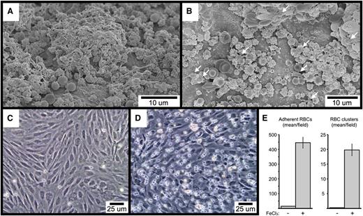 Figure 7. SEM visualization of carotid artery FeCl3-induced thrombosis in VWF-deficient (A), and GPIb-α extracellular domain–deficient mice (B). The few platelets in (B) are indicated with arrows. The time course is 4 minutes after FeCl3 application for both samples (A-B). (C-E) The images demonstrate FeCl3-induced adhesion of washed human RBCs to cultured HUVECs under flow. (C) shows the buffer-only control, and (D) the buffer plus FeCl3. The graph in (E) shows the quantitation of adherent RBCs and RBC clusters from 4 independent experiments, with a minimum of 5 random ×20 fields per experiment. Three or more RBCs together were considered a cluster. The error bars represent the standard error of the mean.