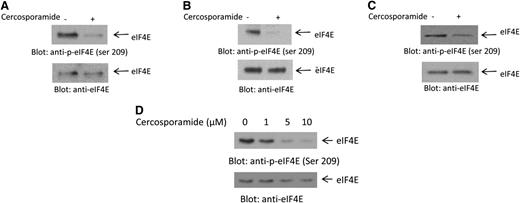 Figure 1. Cercosporamide suppresses phosphorylation of eIF4E. (A) U937 cells were incubated with cercosporamide (10 µM) for 24 hours. Cell lysates were resolved by sodium dodecyl sulfate polyacrylamide gel electrophoresis (SDS-PAGE) and immunoblotted with an antibody against the phosphorylated form of eIF4E on serine 209. The same blot was stripped and reprobed with an antibody against eIF4E, as indicated. (B) MM6 cells were incubated with cercosporamide for 24 hours. Cell lysates were resolved by SDS-PAGE and immunoblotted with an antibody against the phosphorylated form of eIF4E on serine 209. The same blot was stripped and reprobed with an antibody against eIF4E, as indicated. (C) K562 cells were incubated with cercosporamide for 24 hours. Cell lysates were resolved by SDS-PAGE and immunoblotted with an antibody against the phosphorylated form of eIF4E on serine 209. The same blot was stripped and reprobed with an antibody against eIF4E, as indicated. (D) Serum-starved U937 cells were treated for 1 hour with increasing doses of cercosporamide, as indicated. Lysates were resolved by SDS-PAGE and immunoblotted with an antibody against the phosphorylated form of eIF4E on serine 209. The same blot was striped and reprobed with an antibody against eIF4E, as indicated. ser, serine.