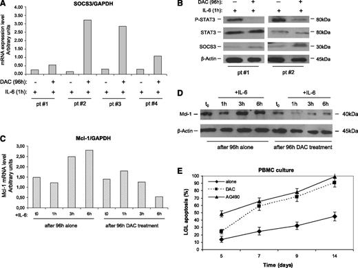 Figure 5. Effect of DAC and IL-6 treatment on SOCS3, STAT3, P-STAT3, and Mcl-1 expression and apoptosis of leukemic LGLs. Results were obtained by LGL cultures treated for 96 hours with or without DAC and then stimulated with IL-6 for 1 hour. (A) SOCS3 expression levels in LGLs obtained by RT-PCR and normalized on GAPDH. The results of 4 representative patients are reported. (B) Western blot analysis of LGL extracts for P-STAT3, total STAT3, and SOCS3. β-Actin served as a loading control. Two representative cases of patients are shown. (C) Mcl-1 expression levels obtained by western blot analysis (D) and by RT-PCR of LGLs from a representative patient with LGLL. (E) Annexin V/PI assay measuring LGL mortality percentage (± SE) in PBMC culture after DAC treatment (4 days of incubation) or with AG490, inhibiting STAT3 signaling. A staining with anti-CD57-FITC was used to identify leukemic LGLs from PBMCs.