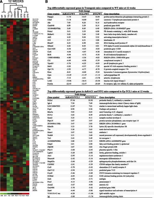 Figure 4. Identification of genes differentially expressed in WT CD19+B220hiCD5− B cells and CD19+CD5+ B cells from dnRAG1, Eμ-TCL1, and DTG mice at 12 weeks. (A) Unsupervised hierarchical clustering of a set of 107 genes that meet the filtering criterion which set the SD for logged data between 0.85 and 1000, and the expression level at >5 in 25% of the samples. (B) A list of common genes among the 50 genes that display the greatest differential expression in WT CD19+B220hiCD5− B cells relative to CD19+CD5+ B cells from all transgenic mice is shown in the top panel. For this analysis, pairwise comparisons were performed using the lower 90% confidence bound interval for genes with ±1.2-fold change filtering criterion. Genes with a mean expression value of <50 in a comparison pair were not included. A list of common genes among the 50 genes that display the greatest differential expression in CD19+CD5+ B cells from dnRAG1 and DTG mice relative to Eμ-TCL1 mice is also shown in the bottom panel.