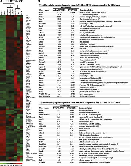 Figure 5. Identification of genes differentially expressed in WT CD19+B220hiCD5− B cells and CD19+CD5+ B cells from ill DTG mice and age-matched dnRAG1 and Eμ-TCL1 mice. (A) Unsupervised hierarchical clustering of a set of 102 genes that meet the filtering criterion which set the SD for logged data between 1.40 and 1000, and the expression level at >5 in 25% of the samples. (B) Pairwise comparisons were performed using the lower 90% confidence bound interval for genes with ±1.5-fold change filtering criterion. Genes with a mean expression value of <50 in a comparison pair were not included. A list of common genes among the 50 genes that display the greatest differential expression in CD19+CD5+ B cells from dnRAG1 and DTG mice relative to Eμ-TCL1 mice is shown in the top panel. A list of 24 genes that display the greatest differential expression (more than twofold) in CD19+CD5+ B cells DTG mice compared with both dnRAG1 and Eμ-TCL1 mice is shown in the bottom panel.
