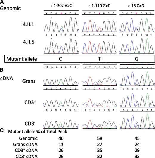 Figure 3. Reduced expression of mutant allele in a patient with c.1017+572C>T. (A) Genomic sequences of GATA2 exons in patient 4.II.1 and her sister 4.II.5 indicate the phase of the SNPs and the mutation. M, K, and S refer to base calls of mixed nucleotide bases at a single site, A/C, G/T, and C/G, respectively. (B) GATA2 cDNA sequences from isolated granulocytes (Grans), CD3+ T-cells (CD3+), and CD3– PBMCs (CD3–) demonstrate reduced expression of c.1017+572C>T allele. (C) Quantitation of relative peak heights of patient 4.II.1 mutant allele as a percentage of the combined peak height at that site.