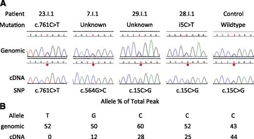 Figure 4. Reduced allelic expression of GATA2 in MonoMAC patients. (A) Genomic vs cDNA GATA2 sequence for patients 23.I.1, 7.I.1, 29.I.1, 28.I.1, and a healthy control. Shown is a portion of the transcript in which the patient is heterozygous at the genomic level with reduced or absent expression of 1 allele by full-length cDNA sequence. Y, S refer to base calls of mixed nucleotide bases at a single site, C/T and C/G, respectively. (B) Quantitation of relative peak heights of patient’s mutant allele as a percentage of the combined peak height at that site.